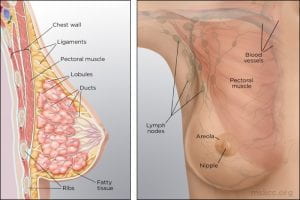 breast cancer case study example