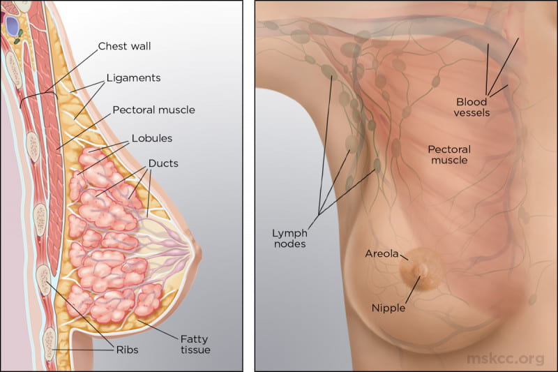 Pathophysiology  Breast Cancer Case Study