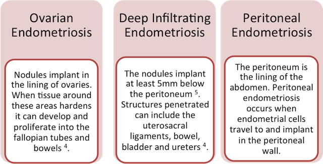 What Is Endometriosis – and What Are My Options?