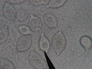 Phytophthora sporangia pp685