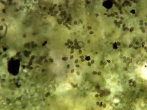 Pseudoperonospora sporangia-4
