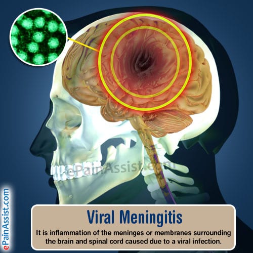 child meningitis case study